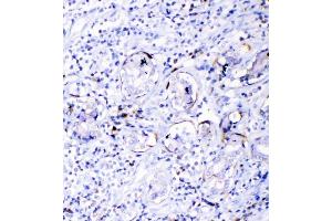 IHC analysis of TL1A using anti-TL1A antibody (ABIN5693289).