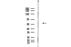 Western blot analysis of lysates from Hela cells(LPS, 4h treatment), using Lyn Antibody at 1/1000 dilution.