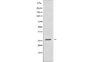 Western blot analysis of extracts from COLO205 cells, using HMGB2 antibody. (HMGB2 anticorps  (Internal Region))