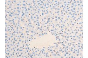 ABIN6267220 at 1/100 staining rat liver tissue sections by IHC-P.