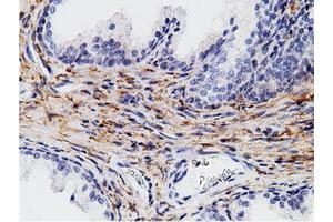 Immunohistochemical staining of paraffin-embedded Human liver tissue using anti-CD80 mouse monoclonal antibody. (CD80 anticorps)
