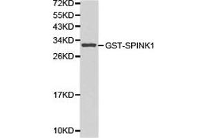 Western blot analysis of GST-SPINK1 recombinant protein using SPINK1 antibody. (SPINK1 anticorps)