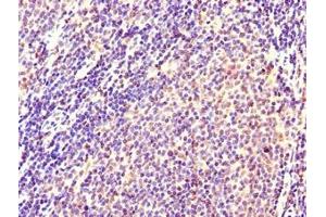 Immunohistochemistry of paraffin-embedded human lymph node tissue using ABIN7146099 at dilution of 1:100