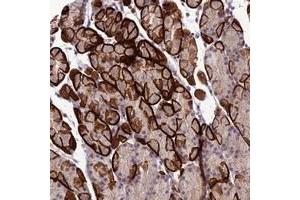 Immunohistochemical staining of human stomach with GDF6 polyclonal antibody  shows strong membranous and cytoplasmic positivity in glandular cells. (GDF6 anticorps)