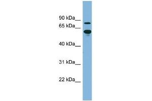 Human kidney; WB Suggested Anti-ABCF2 Antibody Titration: 0. (ABCF2 anticorps  (N-Term))