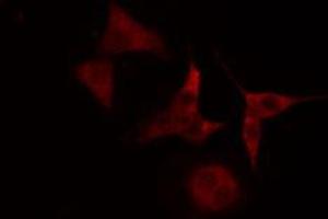 ABIN6272388 staining Hela cells by IF/ICC. (PHKB anticorps  (Internal Region))
