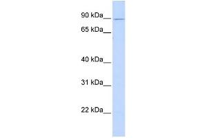 WB Suggested Anti-ZNF408 Antibody Titration:  0. (ZNF408 anticorps  (Middle Region))