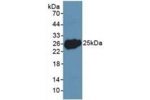 Detection of Recombinant LIF, Human using Polyclonal Antibody to Leukemia Inhibitory Factor (LIF)