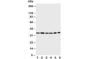 Western blot testing of Cdk4 antibody and Lane 1:  rat thymus;  2: HeLa;  3: MCF-7;  4: A549;  5: COLO320;  6: Jurkat cell lysate (CDK4 anticorps  (C-Term))