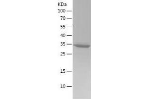 Western Blotting (WB) image for S100 Calcium Binding Protein A5 (S100A5) (AA 1-92) protein (His-IF2DI Tag) (ABIN7124958)
