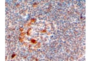 ABIN184577 (4µg/ml) staining of paraffin embedded Human Lymph Node. (ZCCHC11 anticorps  (C-Term))