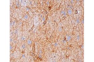 IHC testing of human brain stained with GFAP antibody (GA-5).