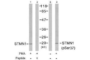 Image no. 2 for anti-Stathmin 1 (STMN1) (pSer37) antibody (ABIN196970) (Stathmin 1 anticorps  (pSer37))