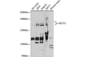 Western blot analysis of extracts of various cell lines, using  antibody (ABIN6129186, ABIN6136561, ABIN6136562 and ABIN6223849) at 1:1000 dilution.