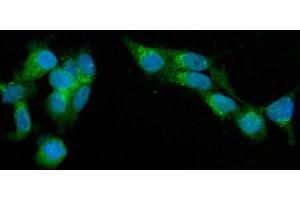 IF analysis of SEC23A using anti-SEC23A antibody (ABIN7600428).