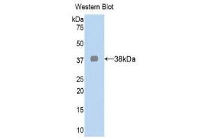 Western Blotting (WB) image for anti-Lactate Dehydrogenase A (LDHA) (AA 1-332) antibody (ABIN1078259) (Lactate Dehydrogenase A anticorps  (AA 1-332))
