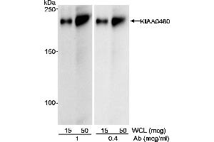 Western Blotting (WB) image for anti-Regulation of Nuclear Pre-mRNA Domain Containing 2 (RPRD2) (AA 1000-1050) antibody (ABIN7452562) (RPRD2 anticorps  (AA 1000-1050))