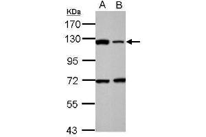 WB Image Sample (30 ug of whole cell lysate) A: 293T B: HeLa 7.