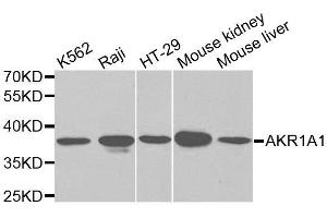 Western blot analysis of extracts of various cell lines, using AKR1A1 antibody. (AKR1A1 anticorps  (AA 1-325))