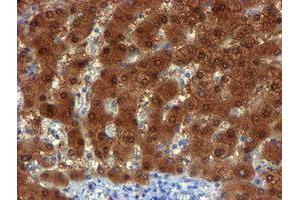 Image no. 2 for anti-NQO2 (NQO2) antibody (ABIN1499816)