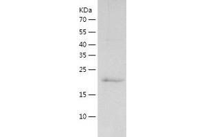 Western Blotting (WB) image for RAP1A, Member of RAS Oncogene Family (RAP1A) (AA 1-181) protein (His tag) (ABIN7124776)