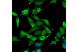 Immunofluorescence analysis of U2OS cells using GAMT Polyclonal Antibody (GAMT anticorps)