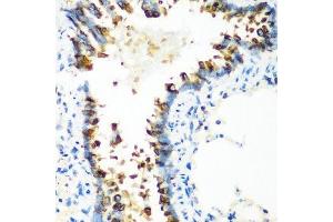 Immunohistochemistry of paraffin-embedded rat lung using MT-CO2 antibody. (COX2 anticorps  (AA 100-200))