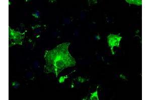 Image no. 11 for anti-Fc Fragment of IgG, Low Affinity IIa, Receptor (CD32) (FCGR2A) antibody (ABIN1497259)