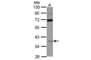 Image no. 1 for anti-Single Stranded DNA Binding Protein 3 (SSBP3) (AA 1-175) antibody (ABIN1501148) (SSBP3 anticorps  (AA 1-175))