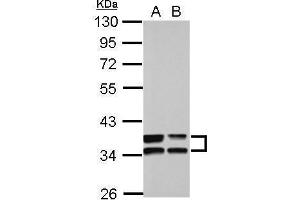 WB Image Sample (30 ug of whole cell lysate) A: A549 B: HCT116 10% SDS PAGE antibody diluted at 1:10000 (Annexin A3 anticorps)