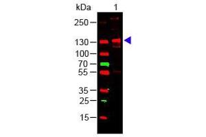 Western Blotting (WB) image for anti-Collagen, Type III (COL3) antibody (ABIN5596830)