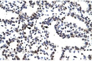 Human Lung; LHX3 antibody - middle region in Human Lung cells using Immunohistochemistry (LHX3 anticorps  (Middle Region))