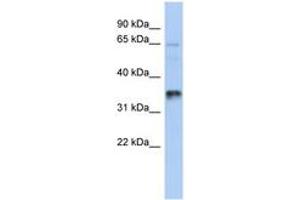 Image no. 1 for anti-UBA Domain Containing 2 (UBAC2) (AA 107-156) antibody (ABIN6743877) (UBAC2 anticorps  (AA 107-156))