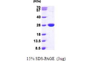 NFNB (AA 1-217) protein (His tag)