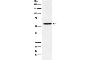 Western blot analysis of DKC1 expression in SW480 cell lysate.