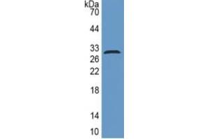 WB of Protein Standard: different control antibodies against Highly purified E. (ITGB6 Kit CLIA)