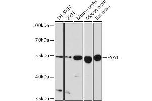 Western blot analysis of extracts of various cell lines, using EY Rabbit pAb (ABIN6135167, ABIN6140386, ABIN6225031 and ABIN6225033) at 1:1000 dilution. (EYA1 anticorps  (AA 100-250))