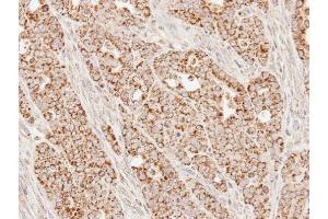 IHC-P Image Immunohistochemical analysis of paraffin-embedded N87 xenograft, using SUCLG1, antibody at 1:100 dilution.