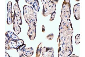 IHC analysis of Neurofibromin/NF1 using anti-Neurofibromin/NF1 antibody (ABIN7600197). (Neurofibromin 1 anticorps  (AA 160-270))
