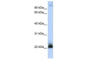 WB Suggested Anti-ITGB3BP Antibody Titration: 0. (ITGB3BP anticorps  (N-Term))