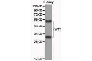 Western Blotting (WB) image for anti-Wilms Tumor 1 (WT1) antibody (ABIN1875356) (WT1 anticorps)
