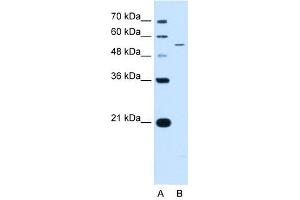 KCNQ2 antibody used at 0. (KCNQ2 anticorps  (N-Term))