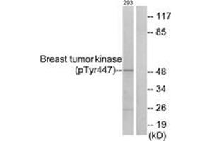 Western blot analysis of extracts from 293 cells treated with EGF 200ng/ml 30', using Breast Tumor Kinase (Phospho-Tyr447) Antibody. (PTK6 anticorps  (pTyr447))