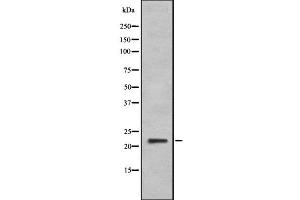 Western blot analysis IFNA6 using HeLa whole cell lysates (IFNA6 anticorps  (C-Term))