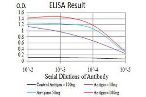 Black line: Control Antigen (100 ng),Purple line: Antigen (10 ng), Blue line: Antigen (50 ng), Red line:Antigen (100 ng)