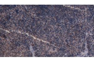 Detection of CASP3 in Rat Spleen Tissue using Polyclonal Antibody to Caspase 3 (CASP3)