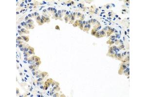 Immunohistochemistry of paraffin-embedded Mouse lung using BMP5 Polyclonal Antibody at dilution of 1:100 (40x lens).
