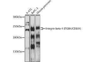 Western blot analysis of extracts of various cells, using Integrin beta 4 (ITGB4/CD104) antibody (ABIN1680489, ABIN3015361, ABIN3015362 and ABIN6214007) at 1:1000 dilution. (Integrin beta 4 anticorps  (AA 28-310))