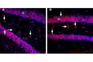 Expression of MANF in rat and mouse hippocampus - Immunohistochemical staining of rat and mouse brain sections using Anti-MANF/ARMET-ATTO Fluor-594 Antibody (ABIN7043331), (1:80).