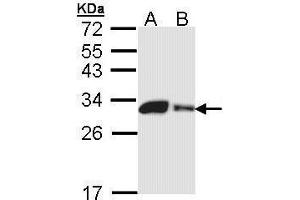 WB Image Sample (30 ug of whole cell lysate) A: 293T B: A431 , 12% SDS PAGE antibody diluted at 1:1000 (CA2 anticorps)